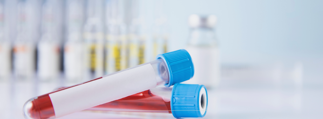 TRT Blood Test